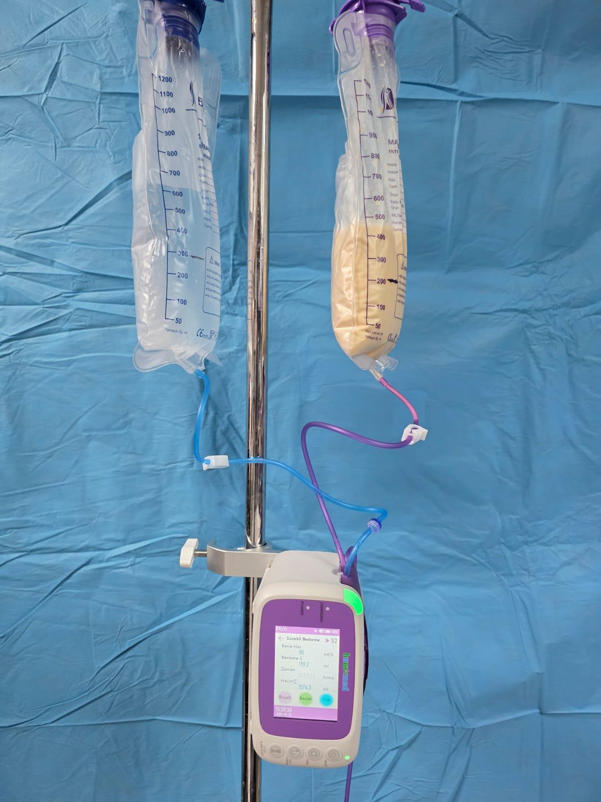 Çiftli enteral beslenme yıkamalı cihazı (hawk) model